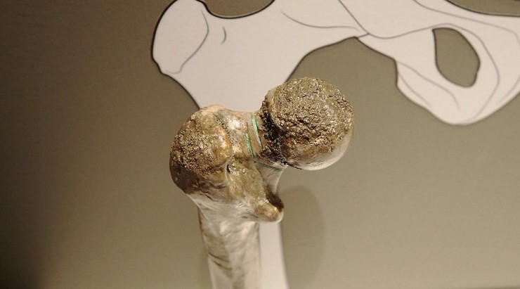 artifact, human bone, cut marks artifact, human bone, cut marks